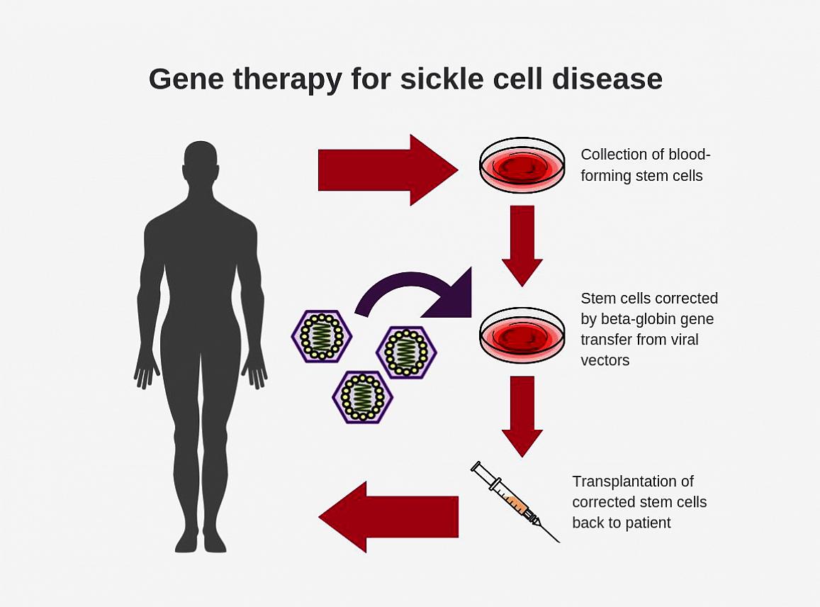 Gene therapy cure diseases