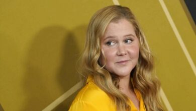 Amy schumer sindrome cushing