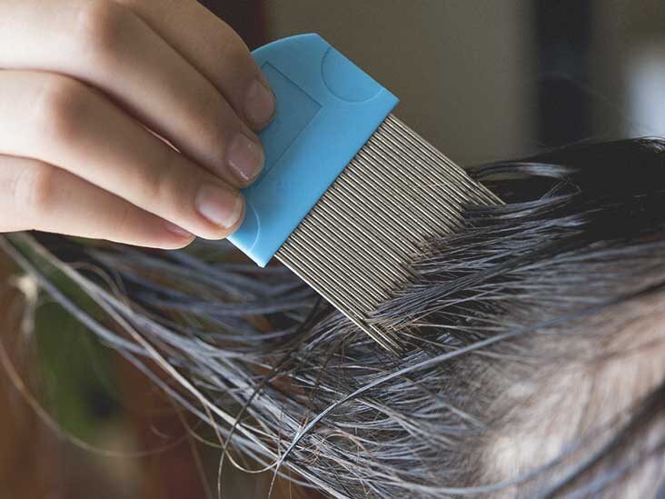 Lice symptoms causes treatment