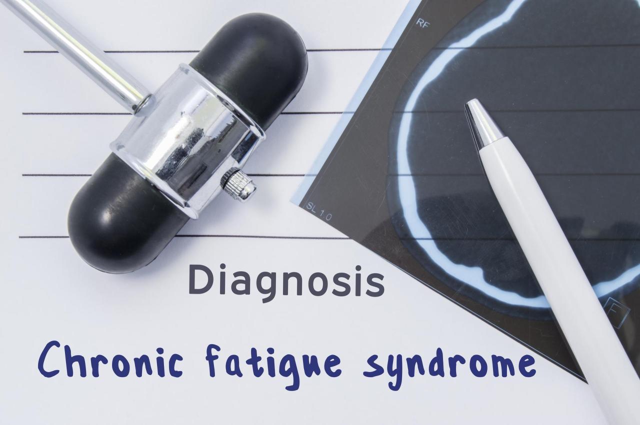 Chronic fatigue syndrome long covid