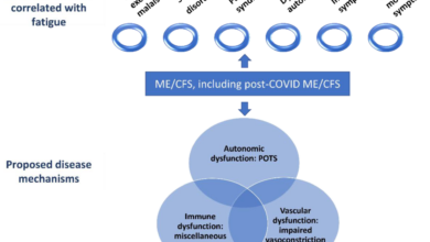 Chronic fatigue syndrome long covid